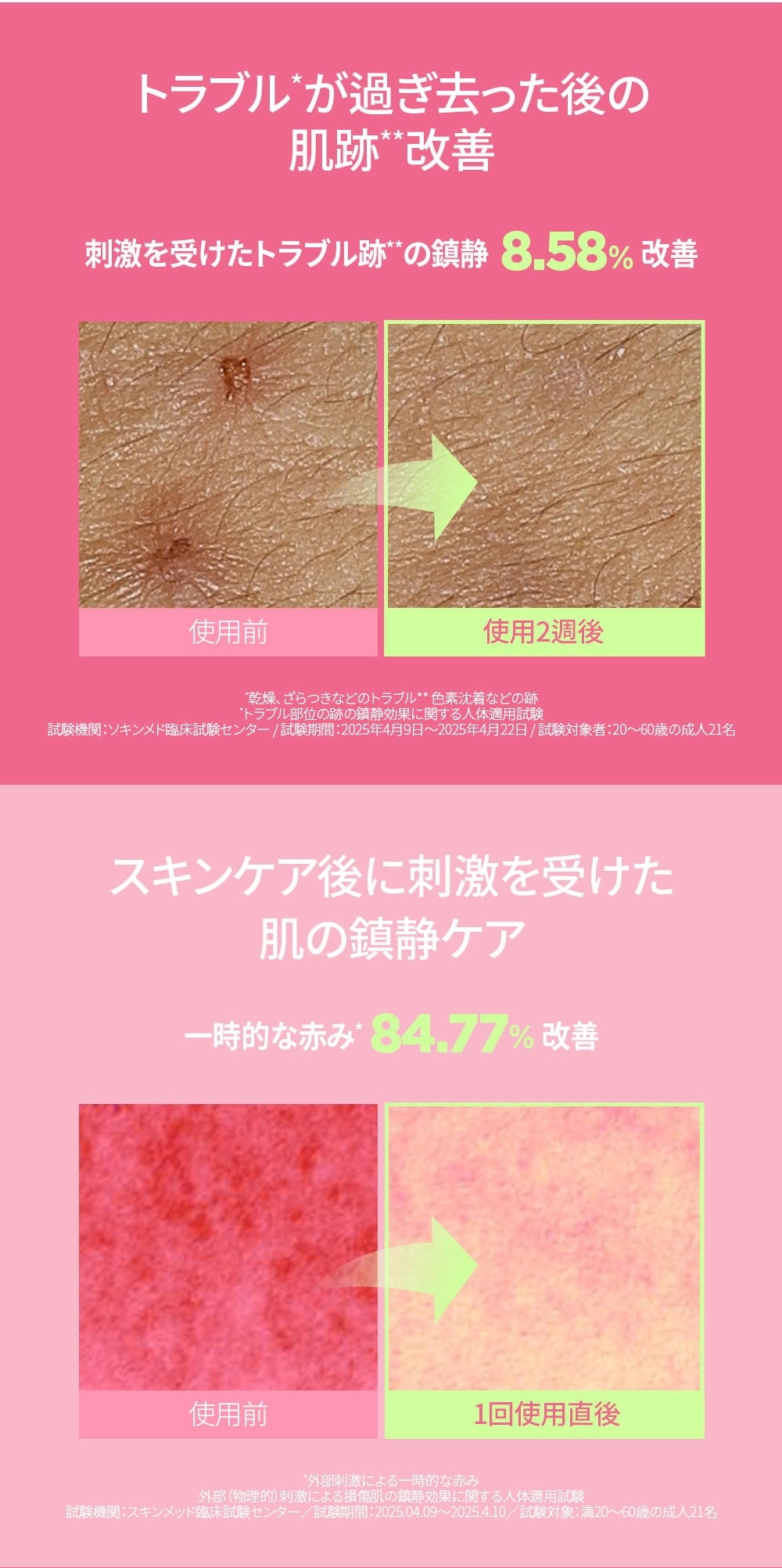 肌荒れ 保湿ケア