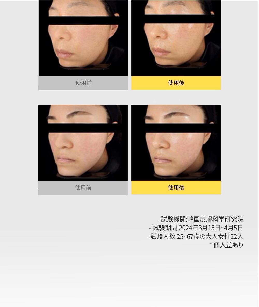 スペシャルケア 保湿マスク 韓国