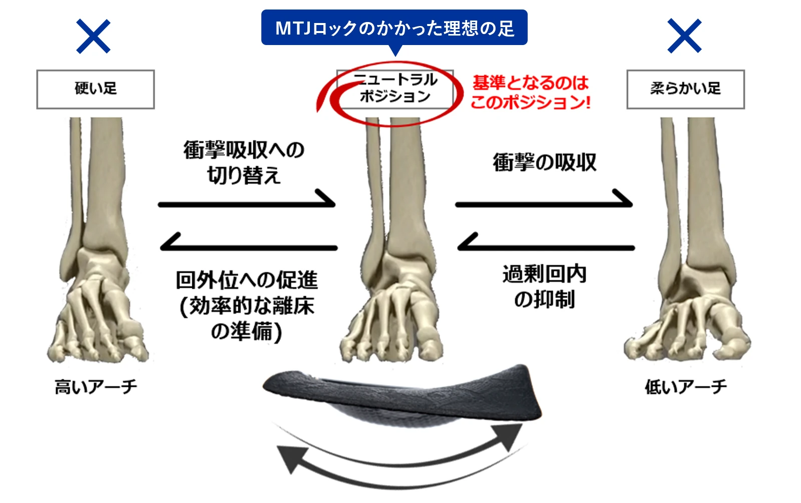 MJTロックのかかった理想の足