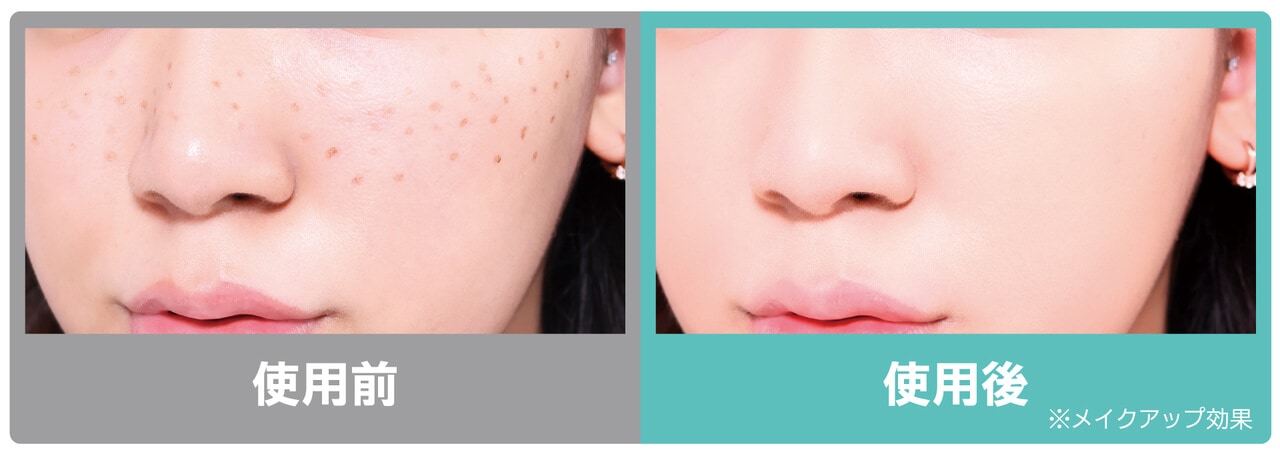 ¥¥ã¥·¡¼¥É¡¼¥ë