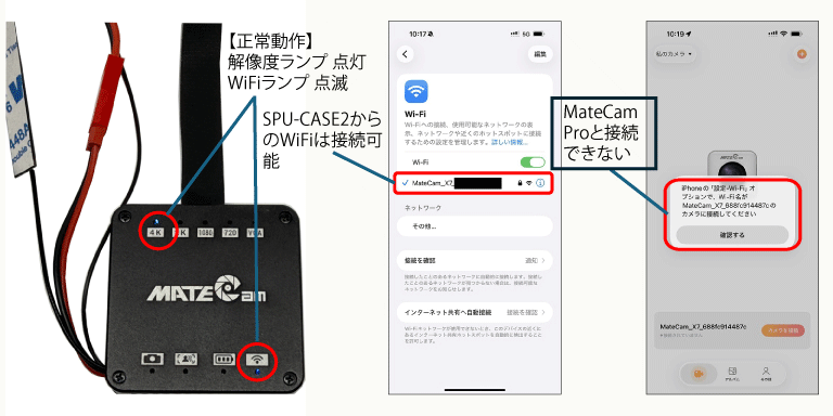 症例2