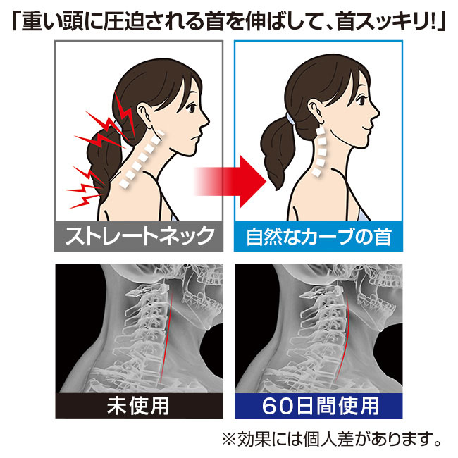 ネックストレッチャー 【通常】｜新聞・カタログ通販「悠遊ショップ」