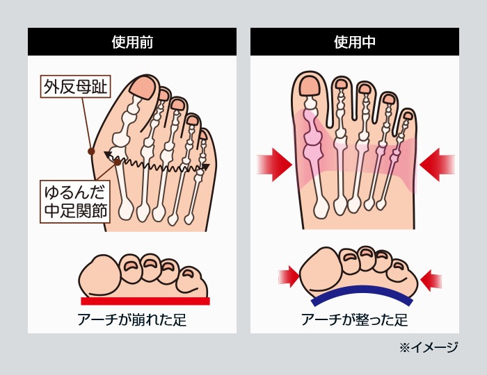 外反母趾靴下 ボシックス 4足組 新聞 カタログ通販 悠遊ショップ