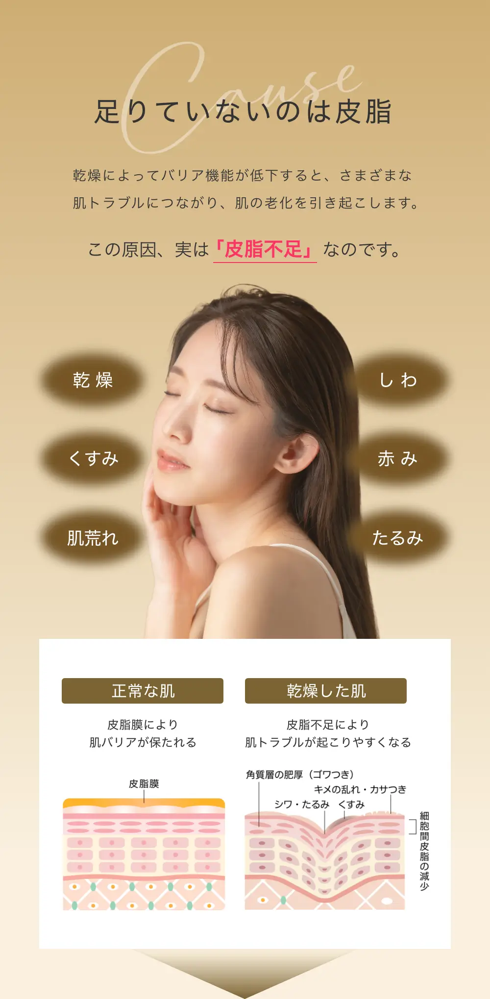 足りていないのは皮脂　乾燥によってバリア機能が低下すると、さまざまな肌トラブルにつながり、肌の老化を引き起こします。この原因、実は「皮脂不足」なのです。