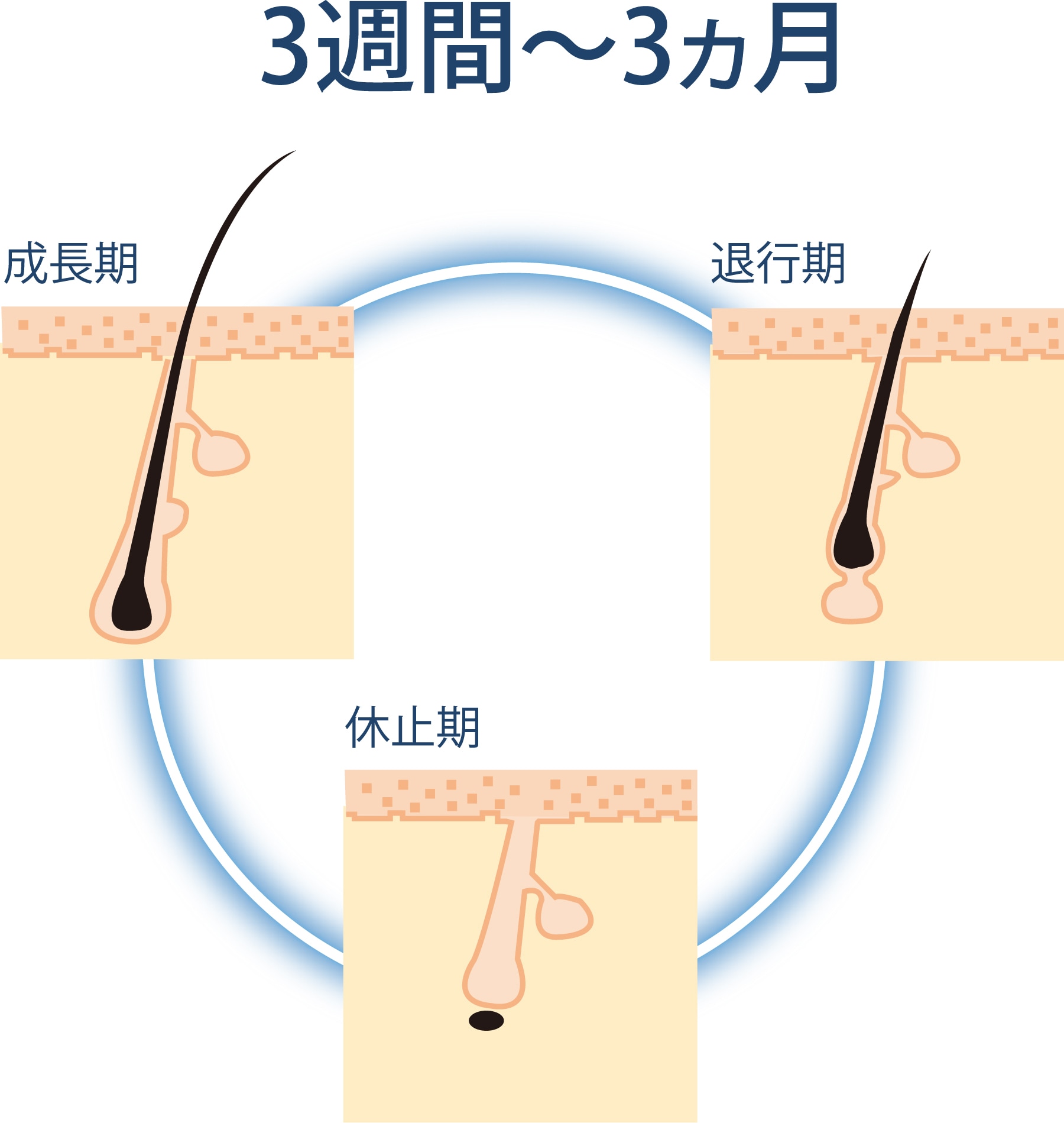 アイラッシュ・エイジレストリートメント