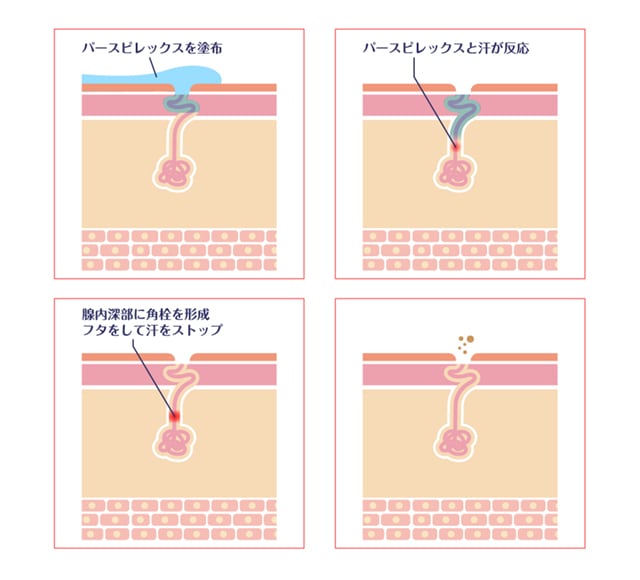 正規通販 パースピレックス 手足用