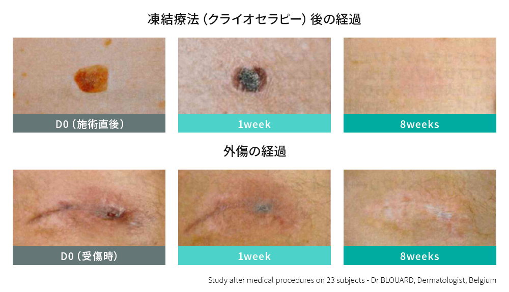 皮膚科学に基づく実証結果を元に開発