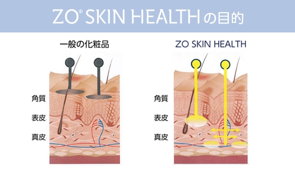 ゼオスキンヘルス（ZO SKIN HEALTH） | 大阪（心斎橋、梅田